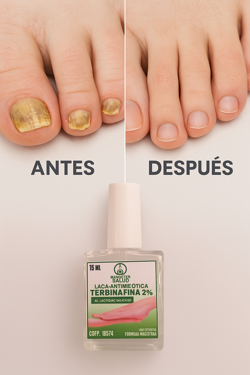 LACA-ANTIMICOTICA CONTRA HONGOS