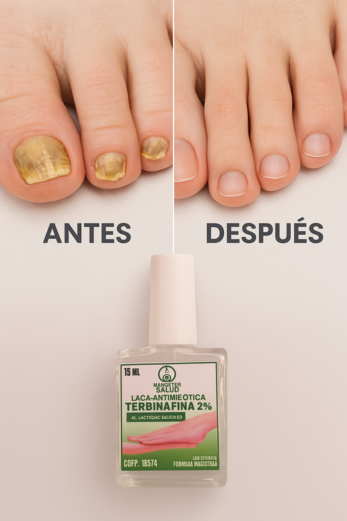 LACA-ANTIMICOTICA CONTRA HONGOS