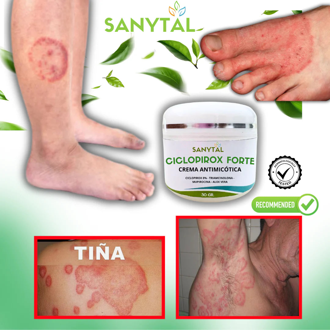 CICLOPIROX FORTE 8% - ELIMINA LA TIÑA INGUINAL- M0160